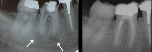 endodonzia-0
