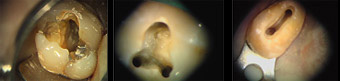 endodonzia-2