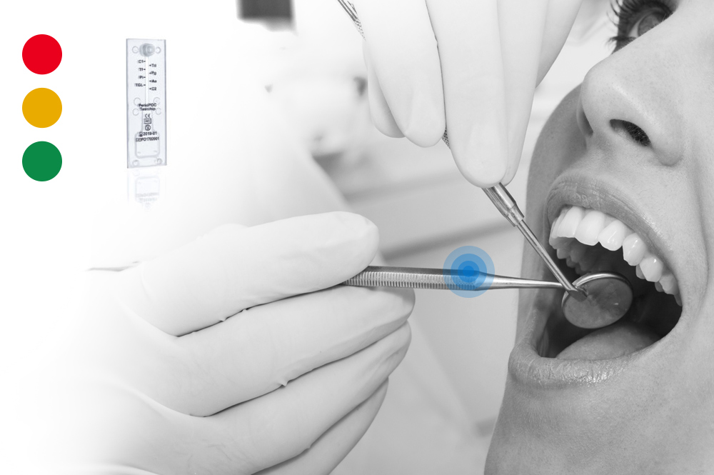 A microbiological test is available to improve the diagnosis and therapy of periodontal disease