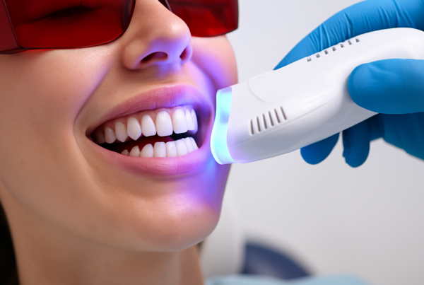 Quanto costa lo sbiancamento dentale